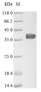 Recombinant Human Type-1 angiotensin II receptor-associated protein (AGTRAP)