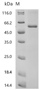 Recombinant Escherichia coli Probable phosphatidylethanolamine transferase Mcr-1 (mcr1)