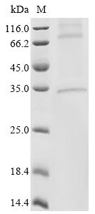Recombinant Human Calcium release-activated calcium channel protein 1 (ORAI1)