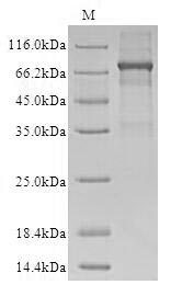Recombinant Human Metalloendopeptidase OMA1, mitochondrial (OMA1) (Active)