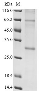 Recombinant Human Insulin-induced gene 2 protein (INSIG2)