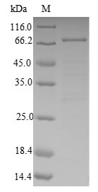 Recombinant Human 4-aminobutyrate aminotransferase, mitochondrial (ABAT)