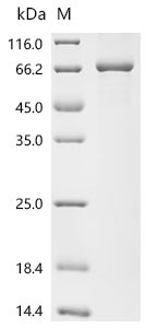 Recombinant Human Acetylcholinesterase (ACHE)