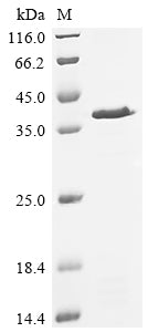 Recombinant Saccharomyces cerevisiae Actin-related protein 5 (ARP5), partial