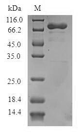 Recombinant Human Arf-GAP with dual PH domain-containing protein 1 (ADAP1)