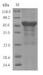 Recombinant Mouse Serine--pyruvate aminotransferase, mitochondrial (Agxt)