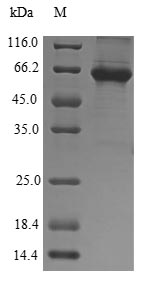 Recombinant Human 5-aminolevulinate synthase, erythroid-specific, mitochondrial (ALAS2)