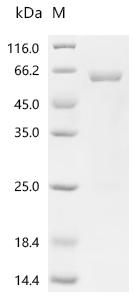 Recombinant Human Aldehyde dehydrogenase, mitochondrial (ALDH2)