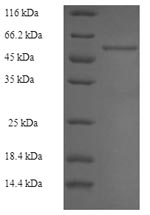 Recombinant Rabbit Fructose-bisphosphate aldolase B (ALDOB)