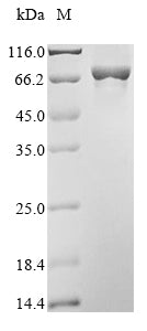 Recombinant Human Arachidonate 12-lipoxygenase, 12S-type (ALOX12)
