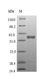 Recombinant Mouse Anthrax toxin receptor 1 (Antxr1), partial