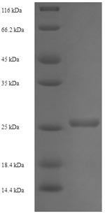 Recombinant Human ADP-ribosylation factor-like protein 4A (ARL4A)