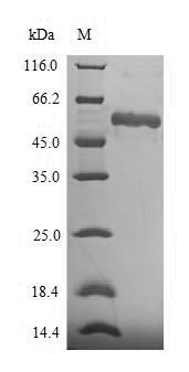 Recombinant Human Asporin (ASPN)