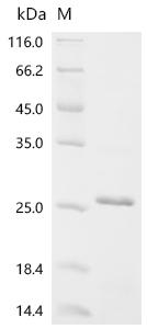 Recombinant Human Astrotactin-1 (ASTN1), partial