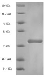 Recombinant Bovine Beta-1,4-galactosyltransferase 1 (B4GALT1), partial