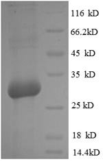 Recombinant Rat Osteocalcin (Bglap)