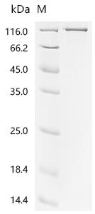 Recombinant Human Bone morphogenetic protein 1 (BMP1)