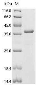 Recombinant Human Tyrosine-protein kinase BTK (BTK) (C481S), partial