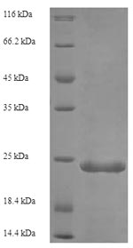 Recombinant Human Complement C5 (C5), partial