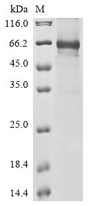 Recombinant Human Complement component C8 beta chain (C8B)