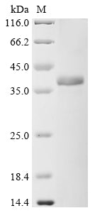 Recombinant Human Complement component C9 (C9), partial