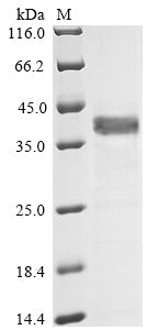 Recombinant Human Complement component C9 (C9), partial