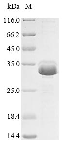 Recombinant Human Calmodulin (CALM1)