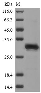 Recombinant Human Calcium/calmodulin-dependent protein kinase II inhibitor 1 (CAMK2N1)