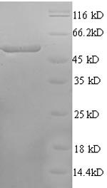 Recombinant Rat Calcium/calmodulin-dependent protein kinase type IV (Camk4)