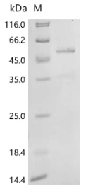 Recombinant Human Caspase-2 (CASP2)