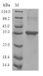 Recombinant Human Eotaxin (CCL11)