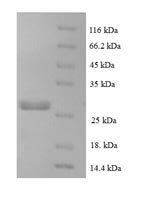 Recombinant Human C-C motif chemokine 16 (CCL16)