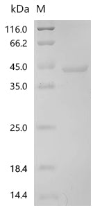 Recombinant Human C-C motif chemokine 2 (CCL2)