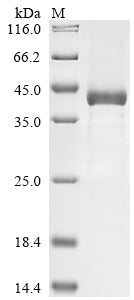 Recombinant Human Complement factor I (CFI), partial