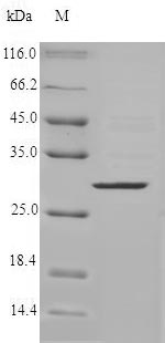 Recombinant Human Chymase (CMA1)