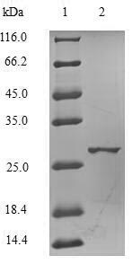 Recombinant Human Catechol O-methyltransferase (COMT), partial