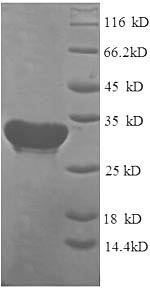 Recombinant Human Cytochrome c oxidase subunit 4 isoform 1, mitochondrial (COX4I1)