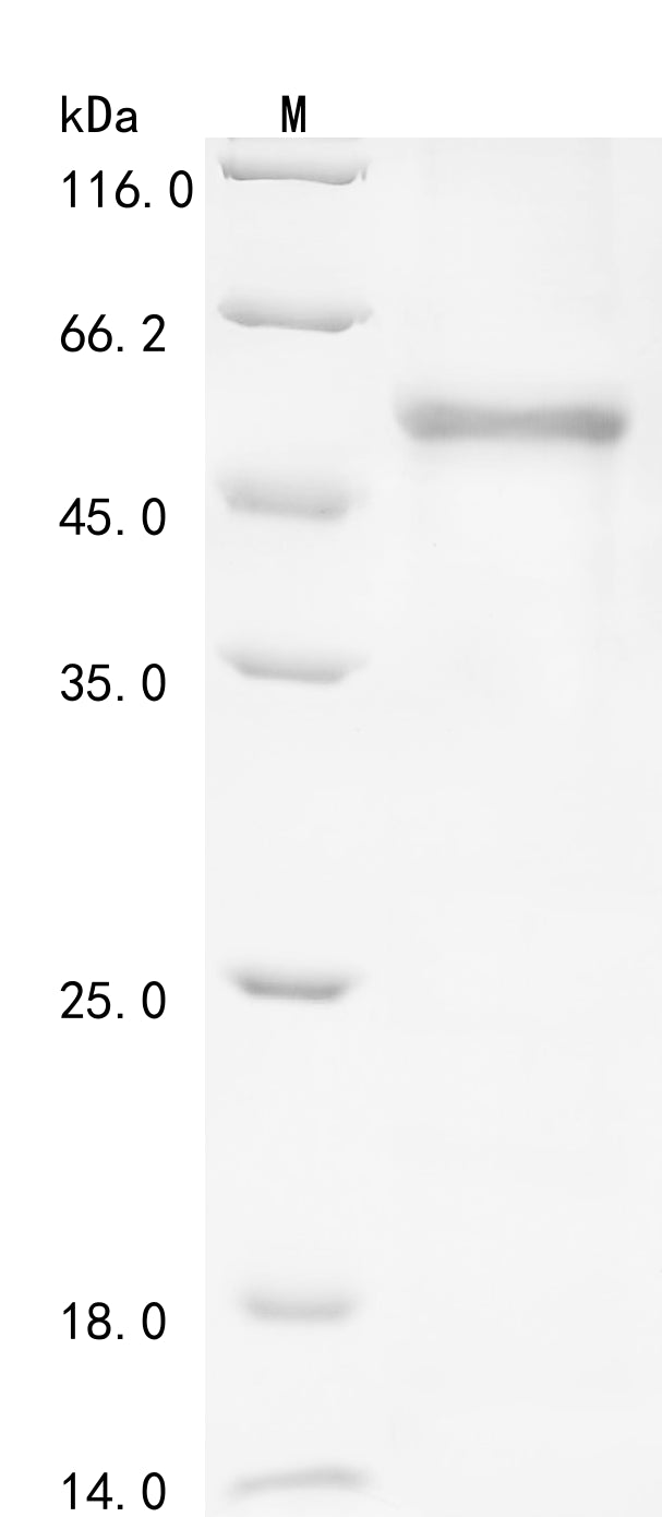 Recombinant Human Carboxypeptidase N subunit 2 (CPN2)