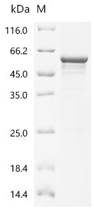 Recombinant Human Casein kinase I isoform delta (CSNK1D )