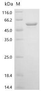 Recombinant Human Casein kinase I isoform delta (CSNK1D )