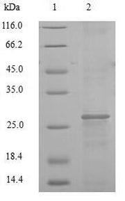 Recombinant Human Cathepsin K (CTSK)