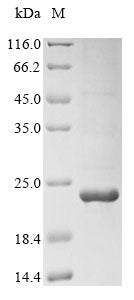 Recombinant Mouse C-X-C chemokine receptor type 3 (Cxcr3), partial
