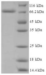 Recombinant Human Cholesterol side-chain cleavage enzyme, mitochondrial (CYP11A1)