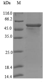 Recombinant Human Steroid 17-alpha-hydroxylase/17,20 lyase (CYP17A1), partial