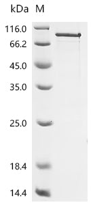 Recombinant Human Deformed epidermal autoregulatory factor 1 homolog (DEAF1)