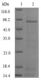 Recombinant Human DNA fragmentation factor subunit alpha (DFFA)
