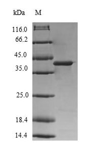 Recombinant Human Diacylglycerol kinase gamma (DGKG), partial