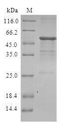 Recombinant Human GTP-binding protein Di-Ras3 (DIRAS3)