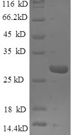 Recombinant Human Epiplakin (EPPK1), partial