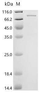 Recombinant Human Eosinophil peroxidase (EPX)